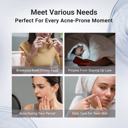Evina™ AcneClear Drying Lotion