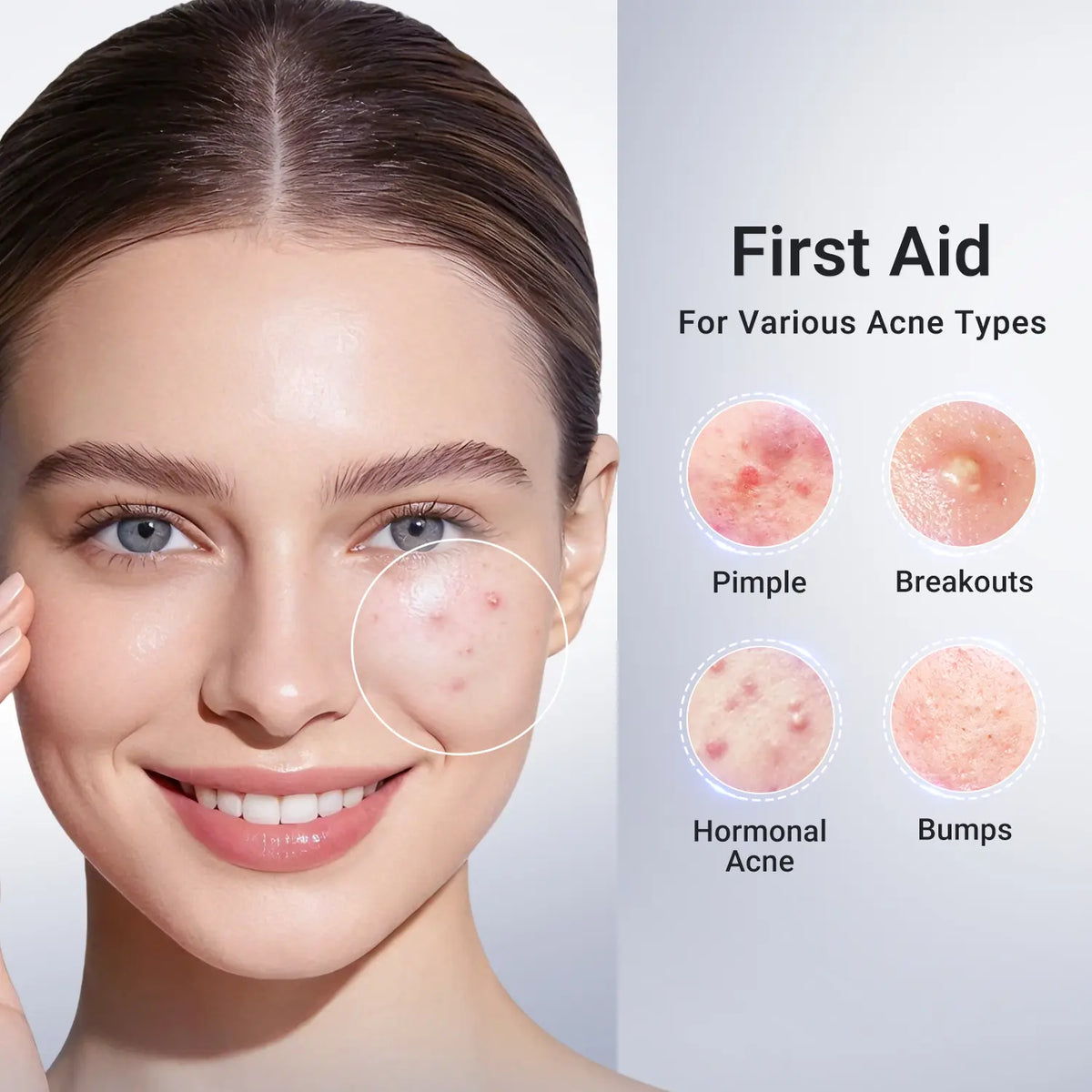 Evina™ AcneClear Drying Lotion