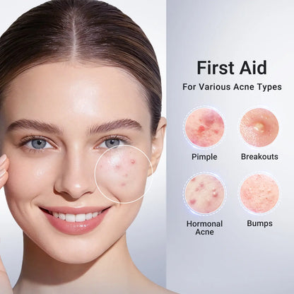 Evina™ AcneClear Drying Lotion